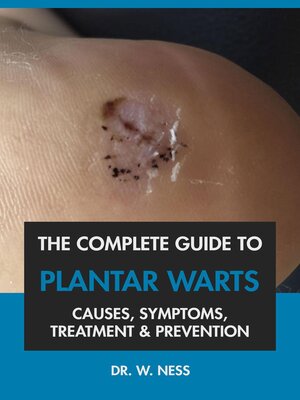 cover image of The Complete Guide to Plantar Warts